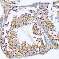 Invitrogen WAVE2 Recombinant Rabbit Monoclonal Antibody (7A6C10) 100 &mu;L;