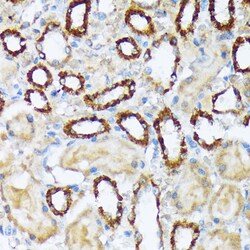 Invitrogen WAVE2 Recombinant Rabbit Monoclonal Antibody (7A6C10) 100 &mu;L;