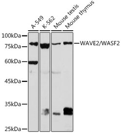Invitrogen WAVE2 Recombinant Rabbit Monoclonal Antibody (7A6C10) 100 &mu;L;