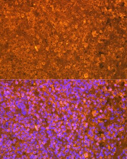 Invitrogen EBI3 Recombinant Rabbit Monoclonal Antibody (9J1H4) 100 &mu;L;