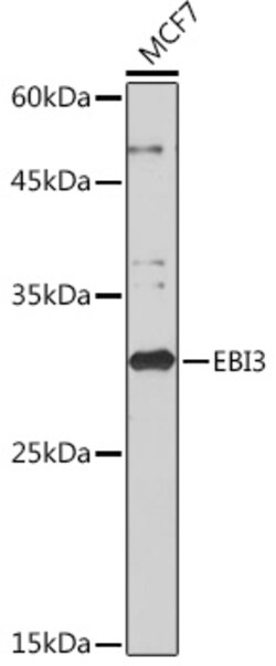 Invitrogen EBI3 Recombinant Rabbit Monoclonal Antibody (9J1H4) 100 &mu;L;