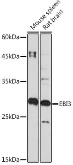 Invitrogen EBI3 Recombinant Rabbit Monoclonal Antibody (9J1H4) 100 &mu;L;