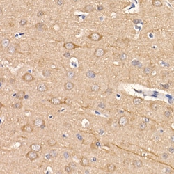 Invitrogen LC3B Recombinant Rabbit Monoclonal Antibody (1S3P9) 100 &mu;L;