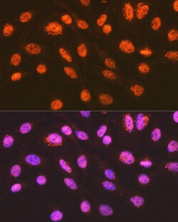 Invitrogen ENT2 Recombinant Rabbit Monoclonal Antibody (7B2J3) 100 &mu;L;