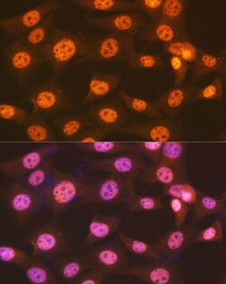 Invitrogen ENT2 Recombinant Rabbit Monoclonal Antibody (7B2J3) 100 &mu;L;