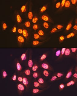 Invitrogen ENT2 Recombinant Rabbit Monoclonal Antibody (7B2J3) 100 &mu;L;