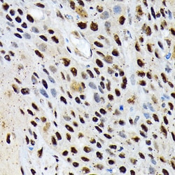 Invitrogen ENT2 Recombinant Rabbit Monoclonal Antibody (7B2J3) 100 &mu;L;
