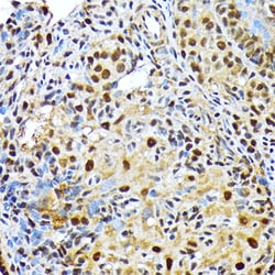 Invitrogen ENT2 Recombinant Rabbit Monoclonal Antibody (7B2J3) 100 &mu;L;