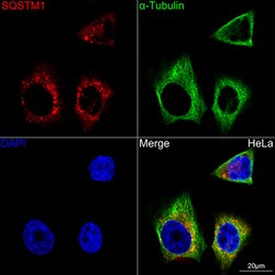 Invitrogen SQSTM1 Recombinant Rabbit Monoclonal Antibody (5X4R1) 100 &mu;L;