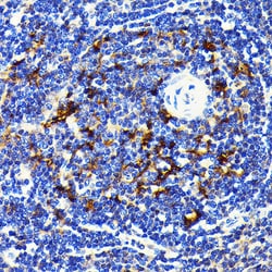 Invitrogen SQSTM1 Recombinant Rabbit Monoclonal Antibody (5X4R1) 100 &mu;L;