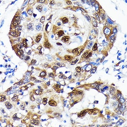 Invitrogen SQSTM1 Recombinant Rabbit Monoclonal Antibody (5X4R1) 100 &mu;L;