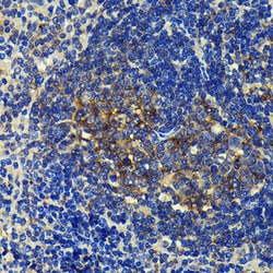 Invitrogen SQSTM1 Recombinant Rabbit Monoclonal Antibody (5X4R1) 100 &mu;L;