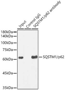 Invitrogen SQSTM1 Recombinant Rabbit Monoclonal Antibody (5X4R1) 100 &mu;L;
