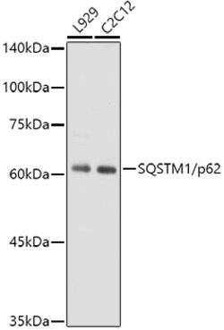 Invitrogen SQSTM1 Recombinant Rabbit Monoclonal Antibody (5X4R1) 100 &mu;L;