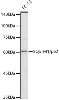 Invitrogen SQSTM1 Recombinant Rabbit Monoclonal Antibody (5X4R1) 100 &mu;L;