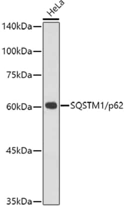 Invitrogen SQSTM1 Recombinant Rabbit Monoclonal Antibody (5X4R1) 100 &mu;L;