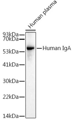 Invitrogen Human IgA Recombinant Rabbit Monoclonal Antibody (10Q6M3) 100 &mu;L | Buy Online | Invitrogen&trade; | Fisher Scientific