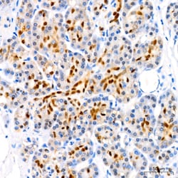 Invitrogen SOX9 Recombinant Rabbit Monoclonal Antibody (5Y4J8) 100 &mu;L;