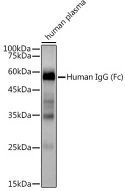 Invitrogen Human IgG Recombinant Rabbit Monoclonal Antibody (1U6H0) 100