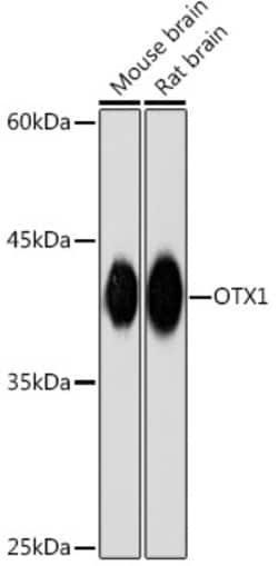 Invitrogen OTX1 Recombinant Rabbit Monoclonal Antibody (6H7J9) 100 &mu;L;