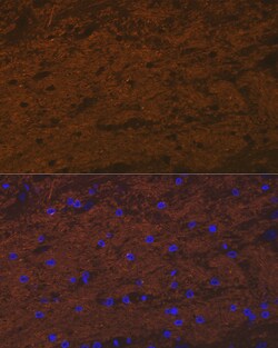 Invitrogen TMOD2 Recombinant Rabbit Monoclonal Antibody (5E7G5) 100 &mu;L;