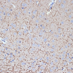 Invitrogen TMOD2 Recombinant Rabbit Monoclonal Antibody (5E7G5) 100 &mu;L;