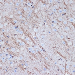 Invitrogen TMOD2 Recombinant Rabbit Monoclonal Antibody (5E7G5) 100 &mu;L;
