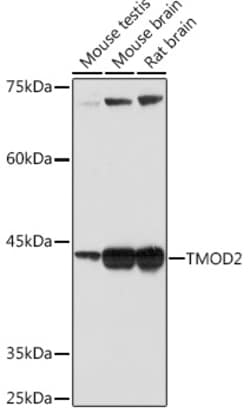 Invitrogen TMOD2 Recombinant Rabbit Monoclonal Antibody (5E7G5) 100 &mu;L;