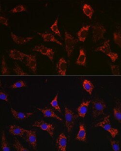 Invitrogen BAX Recombinant Rabbit Monoclonal Antibody (2F7I0) 100 &mu;L;