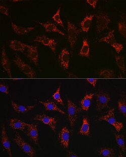 Invitrogen BAX Recombinant Rabbit Monoclonal Antibody (2F7I0) 100 &mu;L;