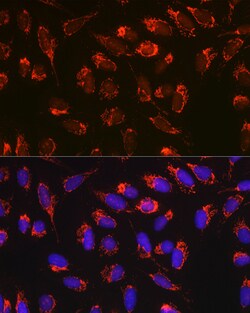 Invitrogen BAX Recombinant Rabbit Monoclonal Antibody (2F7I0) 100 &mu;L;