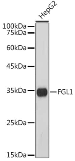 Invitrogen FGL1 Recombinant Rabbit Monoclonal Antibody (5M3E6) 100 &mu;L;