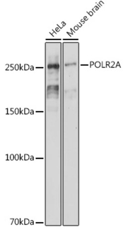 Invitrogen POLR2A Recombinant Rabbit Monoclonal Antibody (8H4A2) 100 &mu;L;
