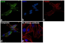 Invitrogen CD70 Recombinant Rabbit Monoclonal Antibody (7F4S5) 100 &mu;L;