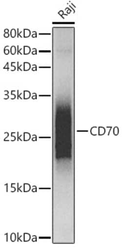 Invitrogen CD70 Recombinant Rabbit Monoclonal Antibody (7F4S5) 100 &mu;L;