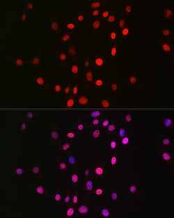 Invitrogen H3K18me1 Recombinant Rabbit Monoclonal Antibody (5Q8V4) 100