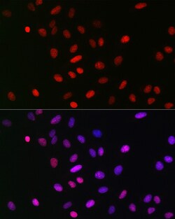 Invitrogen H3K18me1 Recombinant Rabbit Monoclonal Antibody (5Q8V4) 100