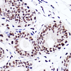 Invitrogen H3K18me1 Recombinant Rabbit Monoclonal Antibody (5Q8V4) 100