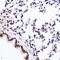 Invitrogen H3K18me1 Recombinant Rabbit Monoclonal Antibody (5Q8V4) 100