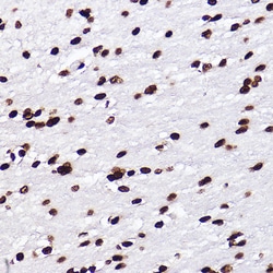 Invitrogen H3K18me1 Recombinant Rabbit Monoclonal Antibody (5Q8V4) 100