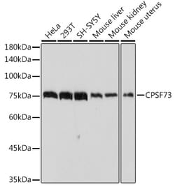 Invitrogen CPSF3 Recombinant Rabbit Monoclonal Antibody (4S4P2) 100 &mu;L | Buy Online | Invitrogen&trade; | Fisher Scientific