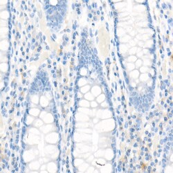 Invitrogen MRP1 Recombinant Rabbit Monoclonal Antibody (0J6M2) 100 &mu;L;
