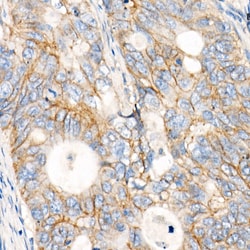 Invitrogen MRP1 Recombinant Rabbit Monoclonal Antibody (0J6M2) 100 &mu;L;