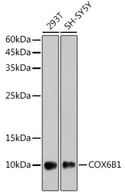 Invitrogen COX6B1 Recombinant Rabbit Monoclonal Antibody (7T0J5) 100 &mu;L;