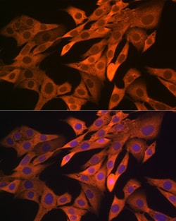 Invitrogen SRP54 Recombinant Rabbit Monoclonal Antibody (1O3J1) 100 &mu;L;