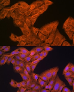 Invitrogen SRP54 Recombinant Rabbit Monoclonal Antibody (1O3J1) 100 &mu;L;