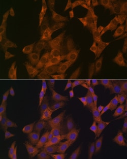 Invitrogen Zyxin Recombinant Rabbit Monoclonal Antibody (4F9P3) 100 &mu;L;