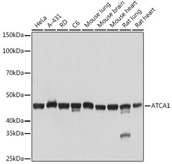 Invitrogen ACTA1 Recombinant Rabbit Monoclonal Antibody (8T8D0) 100 &mu;L;