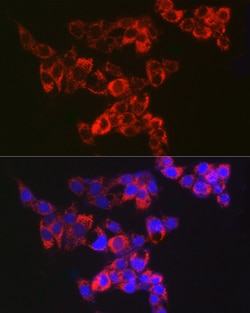Invitrogen Adenylate Kinase 4 Recombinant Rabbit Monoclonal Antibody (9T5P1)