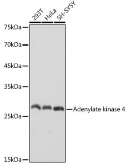 Invitrogen Adenylate Kinase 4 Recombinant Rabbit Monoclonal Antibody (9T5P1)